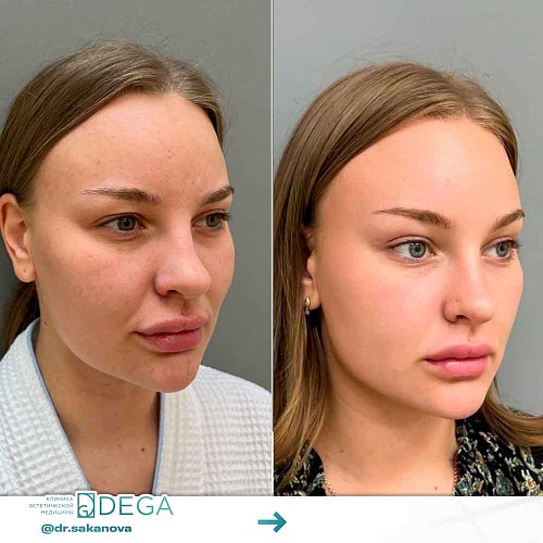 Facial and neck plastic surgeries